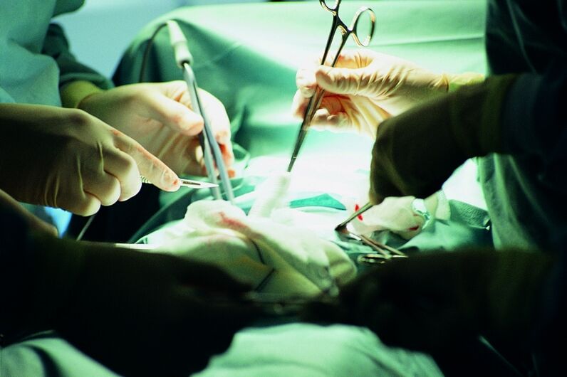 rritje kirurgjikale në trashësinë e penisit