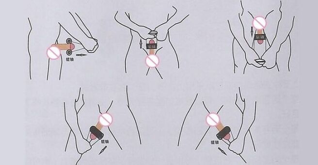 teknikë jelqing për zgjerimin e penisit