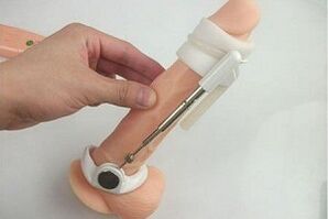 duke përdorur një zgjatues për zgjerimin e penisit